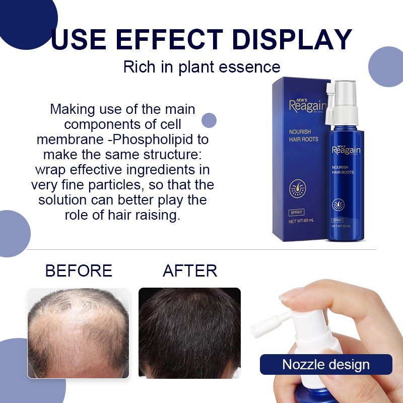 Tinh chất serum kích mọc tóc Kopyrrol dạng xịt 60ml