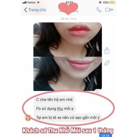 Tinh chất thu nhỏ môi Miracle, hiệu quả chỉ sau 14 ngày