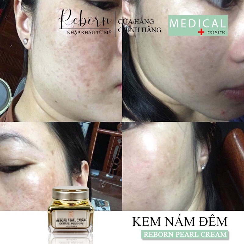 Kem Nám Đêm Reborn Dưỡng Trắng Dành Cho Da Nám_25gr