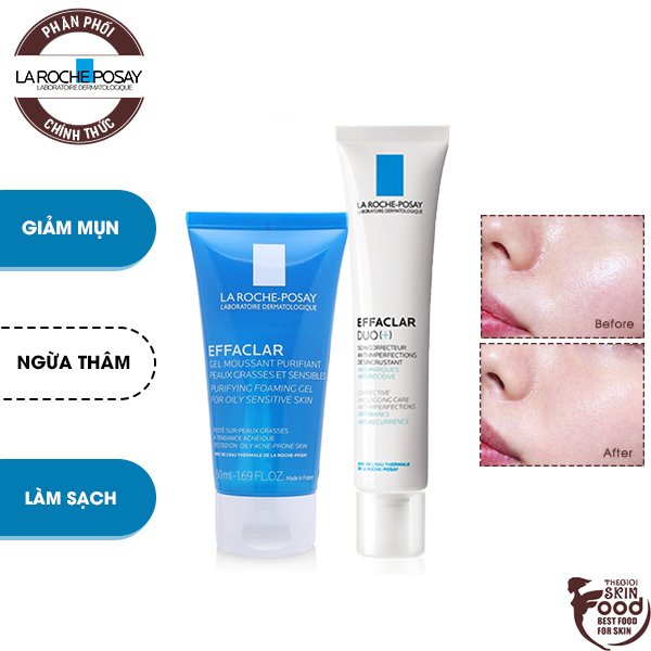 Bộ Đôi Kem Dưỡng Giảm Mụn, Ngừa Thâm La Roche Posay Effaclar Duo+ 40ml Và Gel Rửa Mặt Da Dầu Effaclar Purifying Foaming