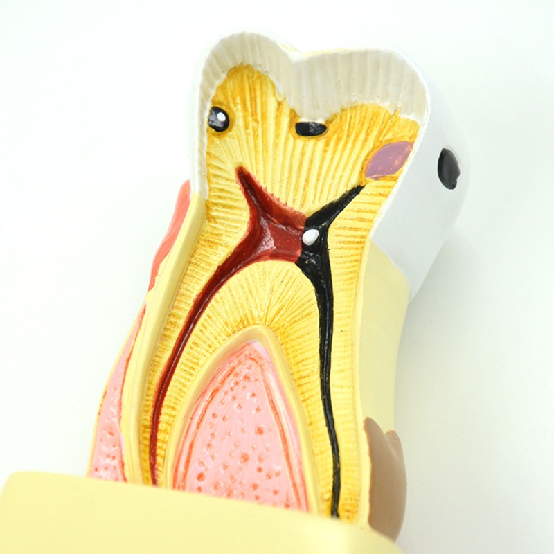 blg Dental Model Periodontal Disease Analysis for Dentist Teaching Dentistry Clinic