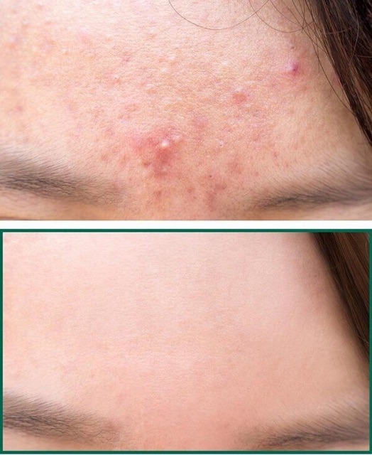 TONER CHO DA DẦU MỤN SIÊU THÍCH EAU PRECIEUSE 375ML | BigBuy360 - bigbuy360.vn