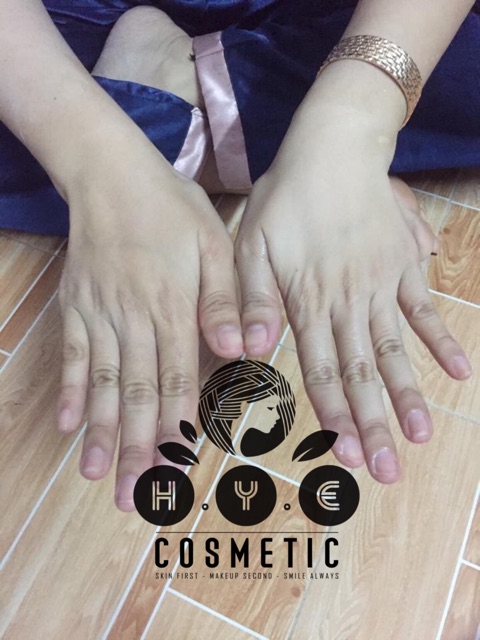 Ủ trắng body hye | BigBuy360 - bigbuy360.vn