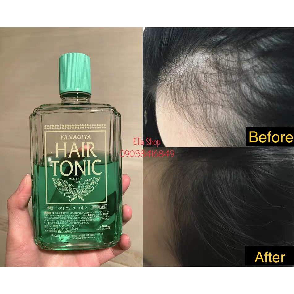 Hair Tonic tinh chất kích thích mọc tóc, giảm rụng, giúp tóc mọc dày và  chắc hơn | Shopee Việt Nam