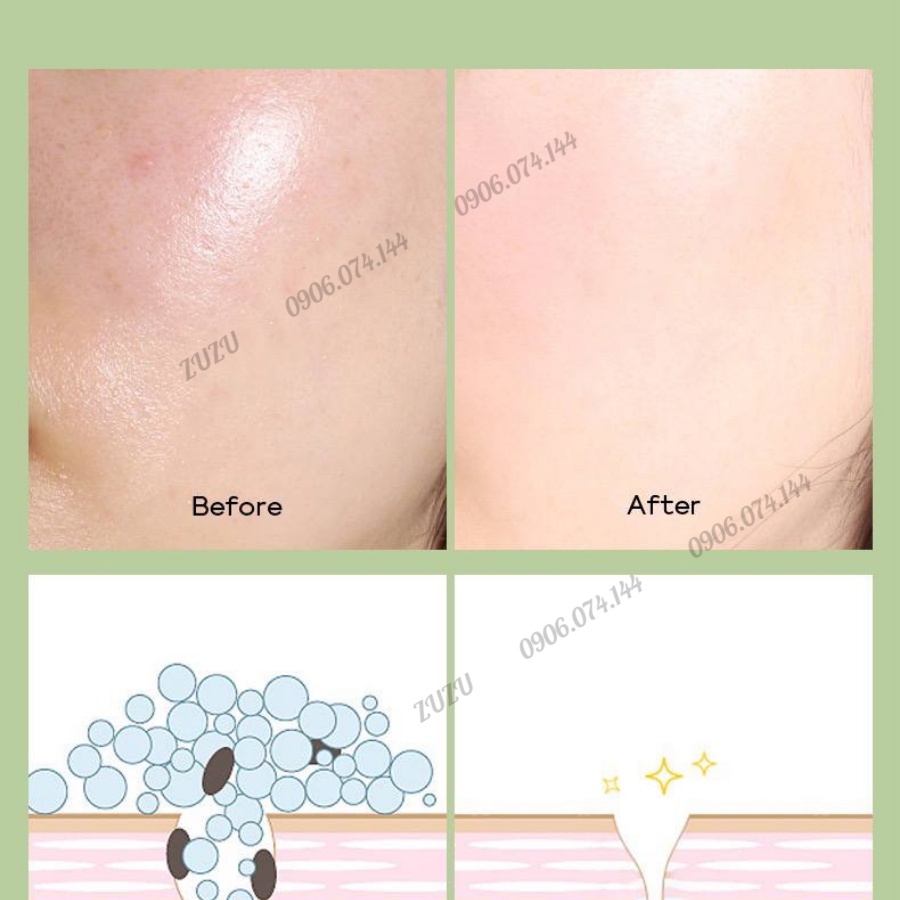 Mặt Nạ Đất Sét Trà Xanh Làm Sạch Sâu Giảm Mụn Đầu Đen làm sạch lỗ chân lông sáng da LALA