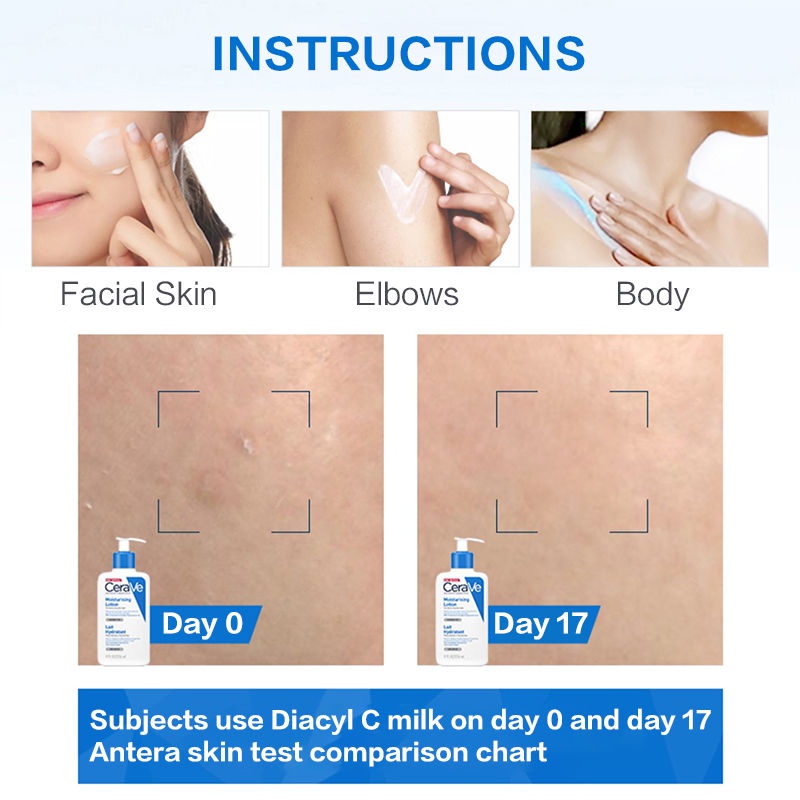 Sữa Dưỡng Ẩm CeraVe Moisturising Lotion 236ml - 473ml