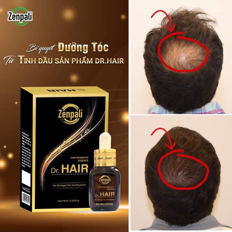 SIÊU PHẨM CẤY MI-MỌC TÓC DR.HAIR