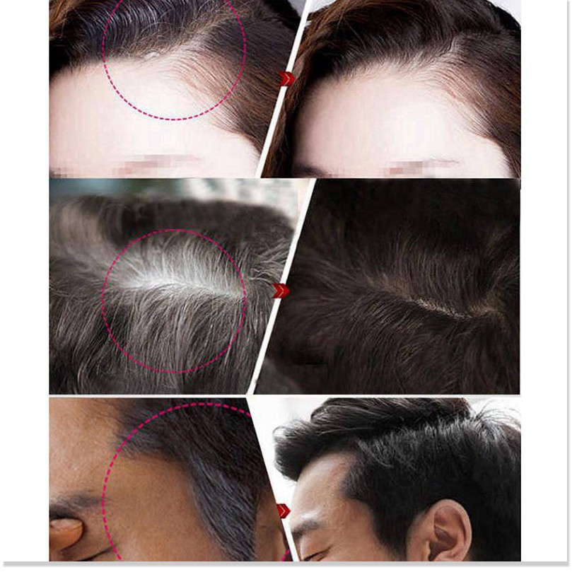 Nhuộm tóc tạm thời ✳️ Cây son nhuộm tóc Saion giúp che phủ tóc bạc nhanh chóng, an toàn cho da đầu 8496 | BigBuy360 - bigbuy360.vn