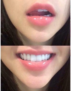 Mặt nạ ngủ môi Carenel
