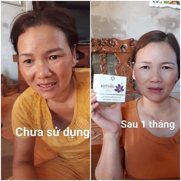Kem Ngừa Nám Tàn Nhang Saffron Hải Âu Việt Dưỡng Trắng Da - Giúp Da Sáng Mịn Đều Màu