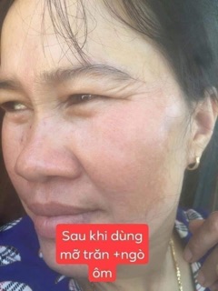 Mỡ trăn N’store 5k
