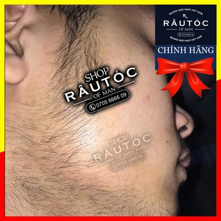Dung dịch serum mọc râu Minoxidil 5% dạng Foam