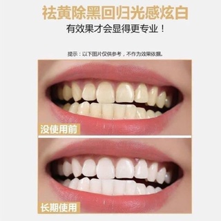 Miếng dán trắng răng 3D WHITE - teeth whitening strips