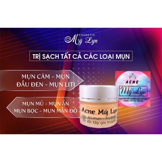 Acne Mỹ Lyn (tặng kèm quà rất xinh)