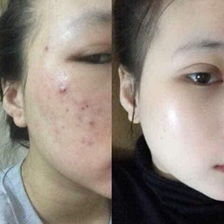 [Chính Hãng] Kem Demejine Hàn Quốc