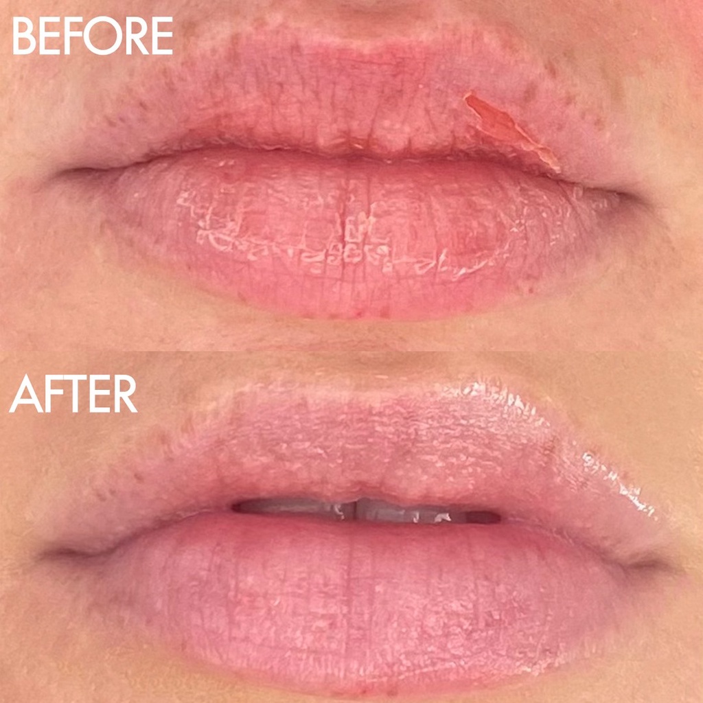 Son dưỡng hương trái cây Lanolips 101 Fruities