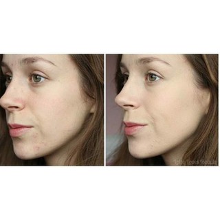 Phấn Phủ Catrice All Matt Plus Shine Control