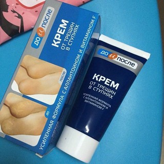 Kem trị nứt gót chân