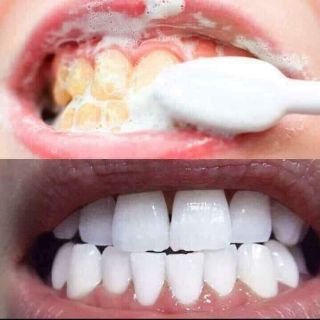 Kem đánh răng trắng sáng Ap24