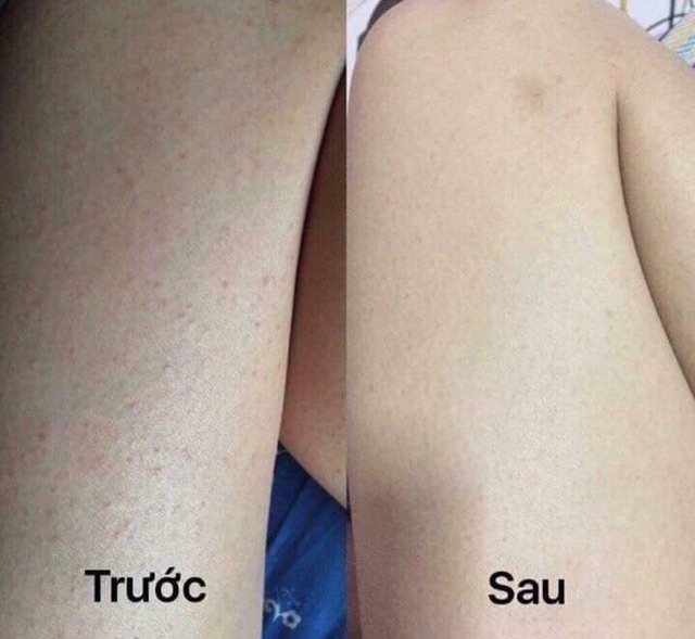 Combo Tẩy Da Chết CREVIL SPA BADESALZ 600g | BigBuy360 - bigbuy360.vn