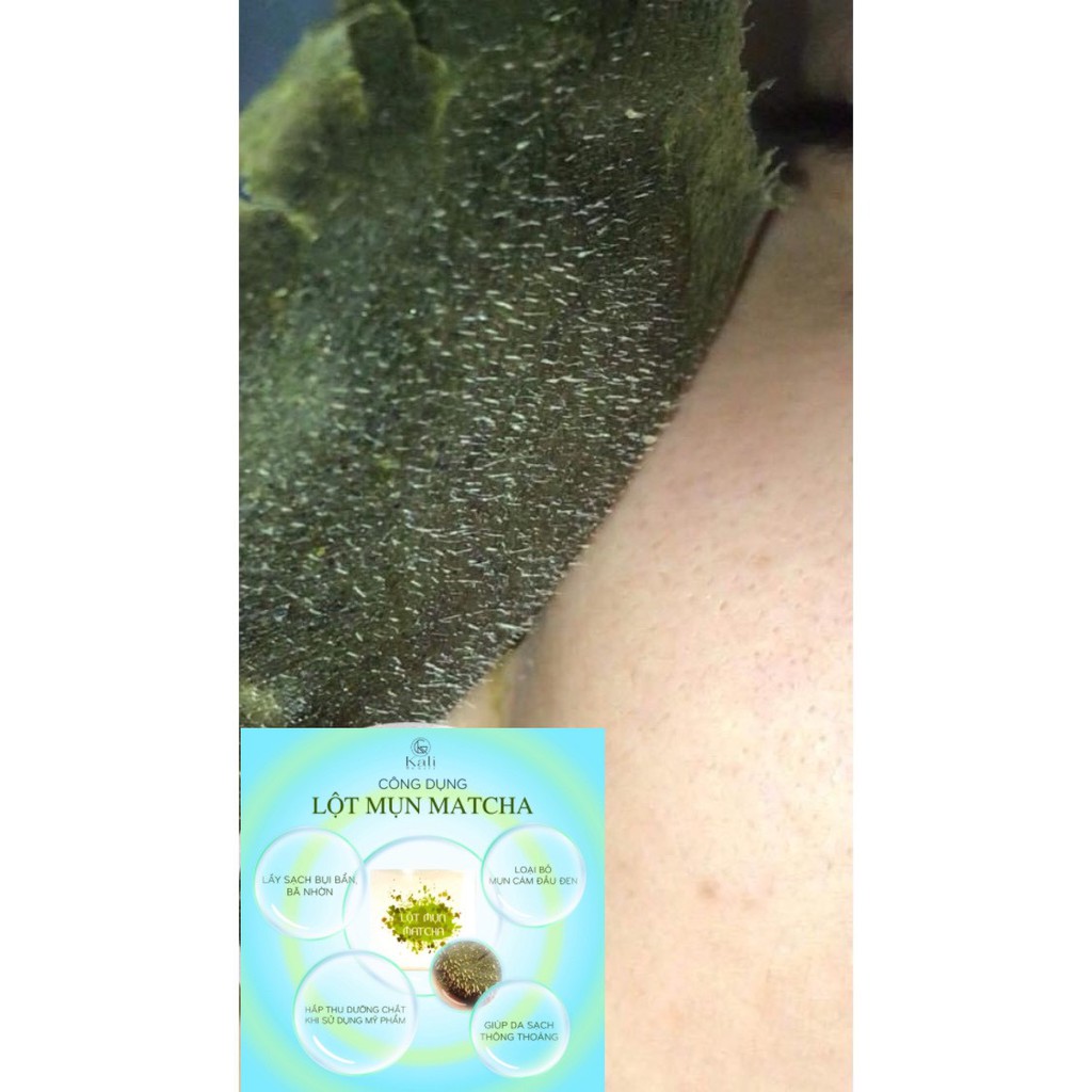 LỘT MỤN MATCHA TRÀ XANH | BigBuy360 - bigbuy360.vn