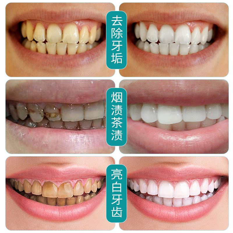 Nicor enzyme pearl whitening tooth powder fresh, dazzling, whitening, removing tooth yellow, whitening, cleaning, teeth