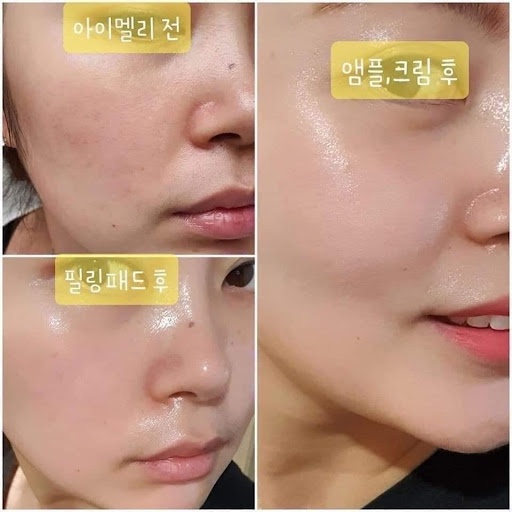 Serum tinh chất vàng 24K Lebelage Heeyul Premium Gold Hàn Quốc - Dưỡng ẩm, chống lão hóa
