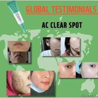 Kem Chấm Mụn Cellmula Ac Clear Spot