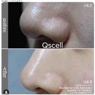 Peel Da Sinh Học Qscell 72h