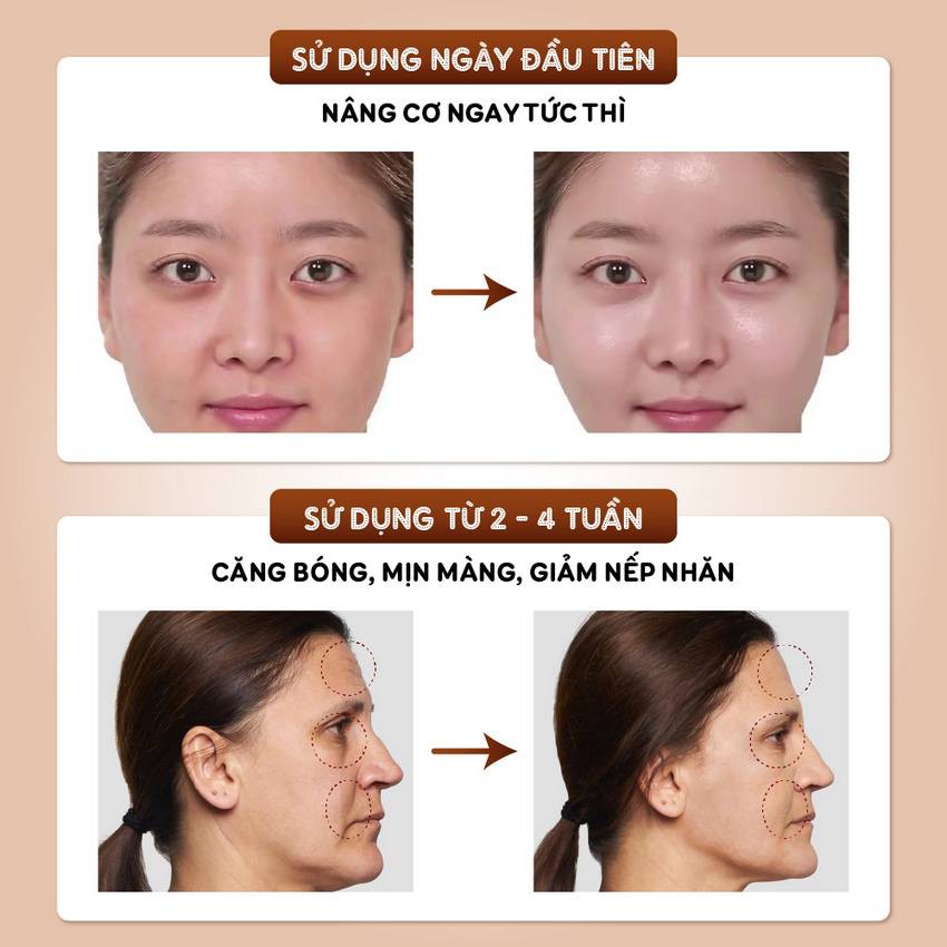 Serum Collagen tơ nâng cơ, căng da Collagen Fiber Thread Lift [Nâng cơ không phẫu thuật] | BigBuy360 - bigbuy360.vn