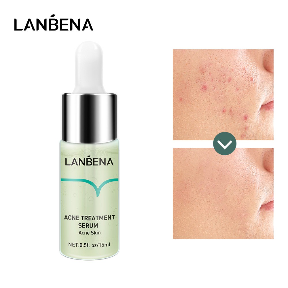 Serum Lanbena 15ml giúp giảm sẹo mụn phục hồi da dưỡng ẩm se khít lỗ chân lông