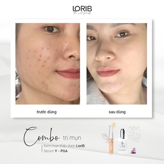 Kem mụn thảo dược Lori B 10ml