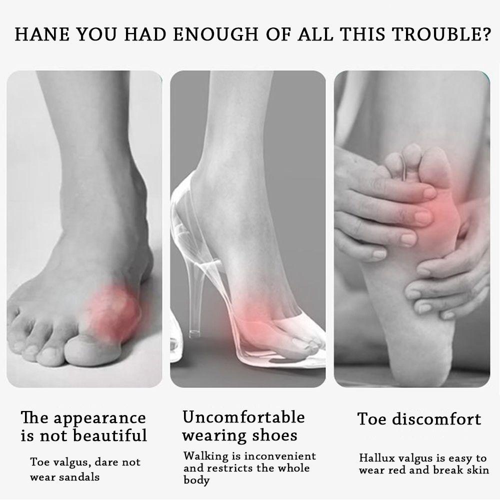 1 Cặp Đệm Silicone Tách Ngón Chân Cái Giảm Đau Điều Chỉnh Được