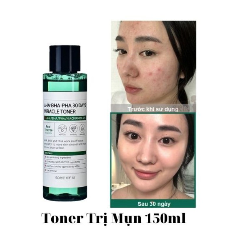 Toner Nước Hoa Hồng Giảm Mụn SOME BY MI AHA-BHA-PHA 30 Days Miracle Toner 150ml