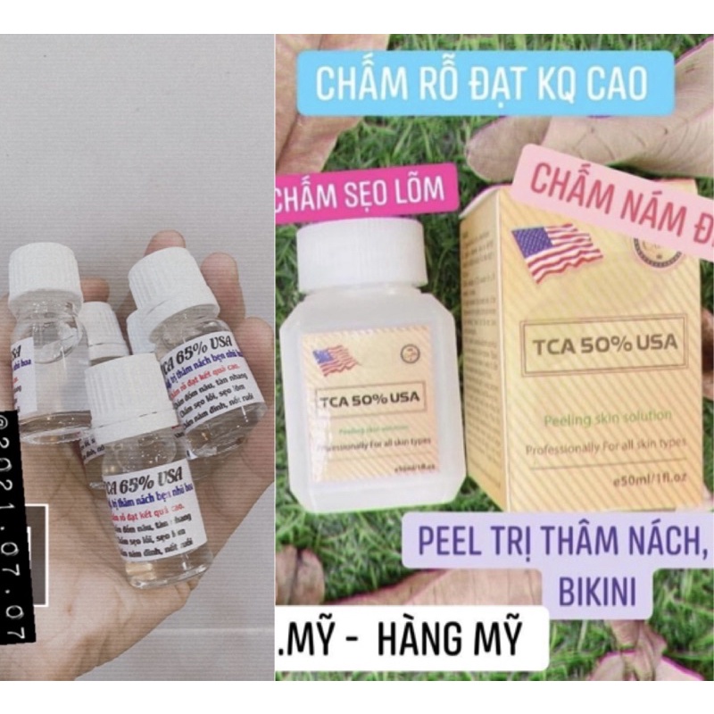 chấm rỗ nám tàn nhan, peell da hết thâm, nách bẹn hàg mỹ, handmade