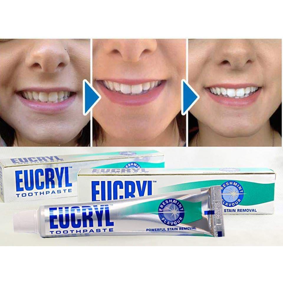 Kem đánh răng Eucryl giúp răng trắng sáng của Anh