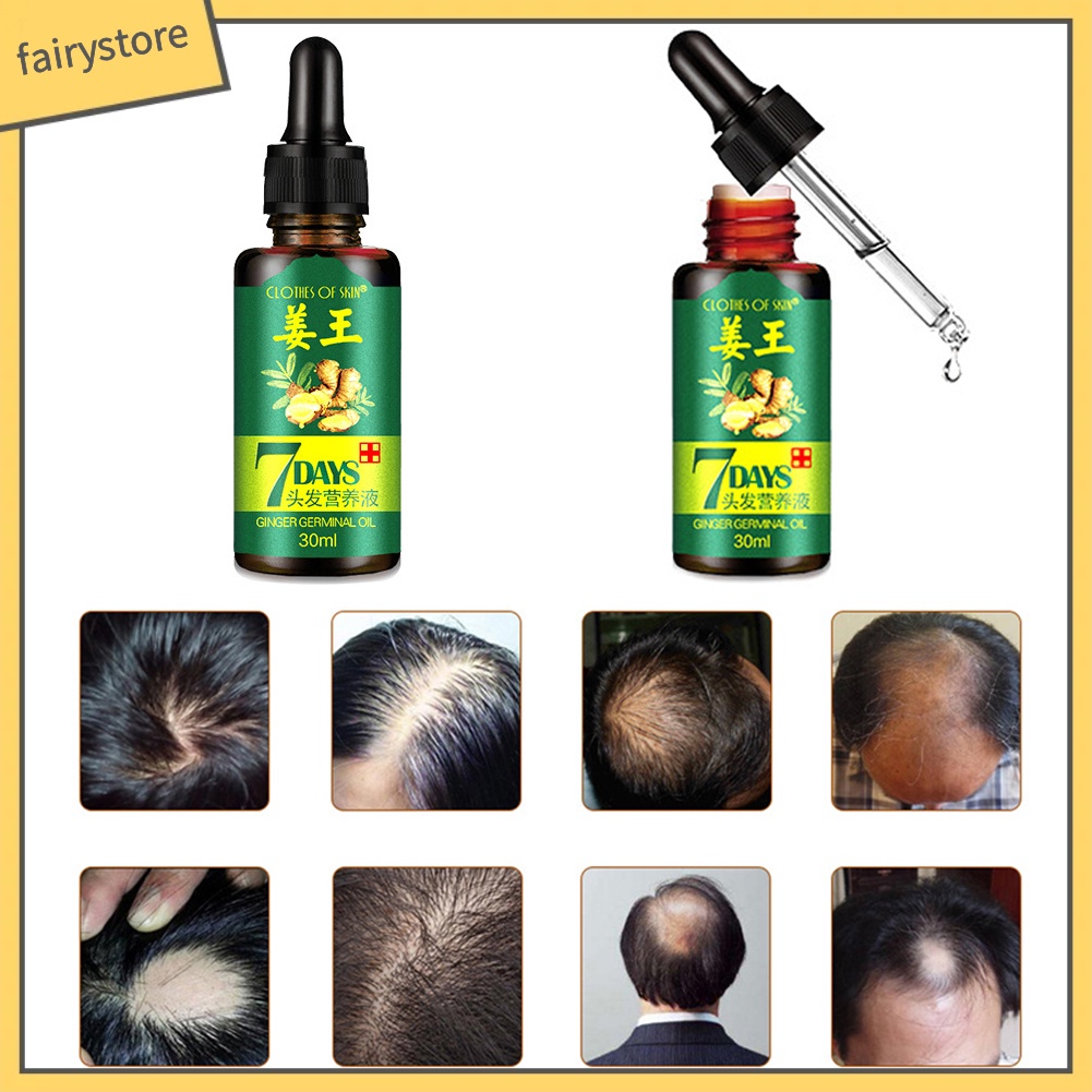 [Hàng mới về] Tinh dầu gừng kích thích mọc tóc an toàn hiệu quả trong 7 ngày