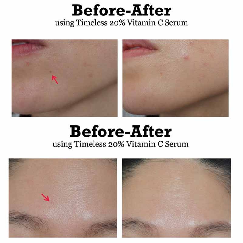 Tinh Chất Giảm Thâm Dưỡng Sáng Da ‪‬Timeless 20% Vitamin C + Vitamin E + Ferulic Acid Serum 30ml