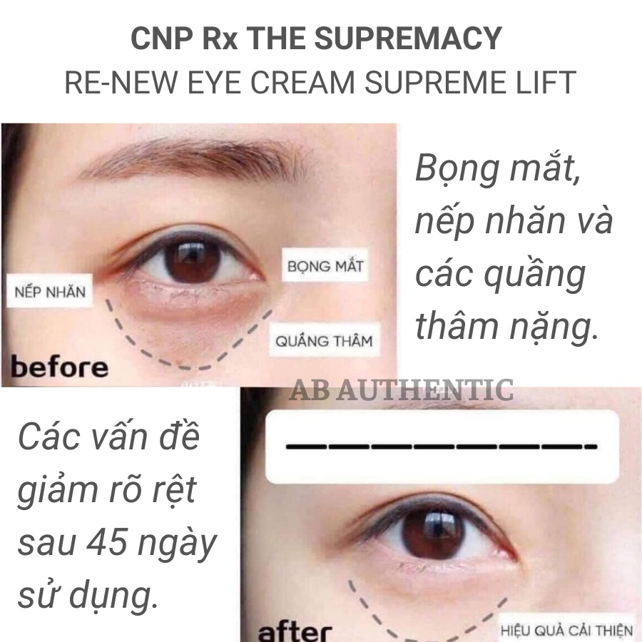 Gói Sample Kem mắt CNP Rx tái tạo The Supremacy Renew Eye Cream - AB Authentic