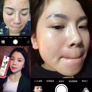 Combo NGỌC SÂM pha sẵn