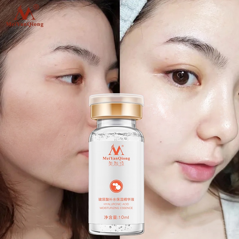 Tinh chất axit hyaluronic MeiYanQiong dưỡng ẩm làm trắng sáng phục hồi làm mịn chăm sóc da Làm trắng sáng sửa chữa Mịn 12ml