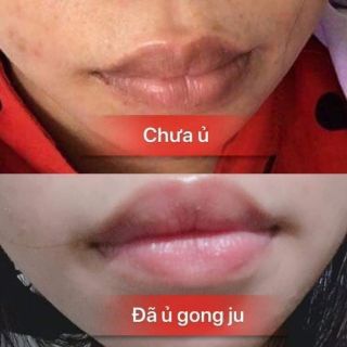 Ủ MÔI GONG JU TEAM YẾN