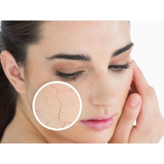 Kem Dưỡng Ẩm Vaseline
