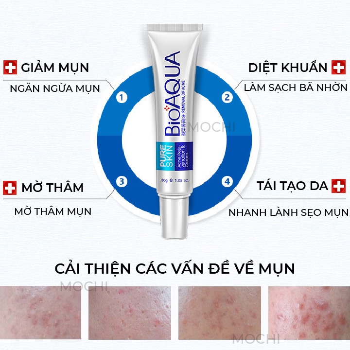 Kem Mụn Acne Bioaqua Giảm Mụn Trứng Cá l Mụn Bọc l Mụn Đầu Đen l Mụn Cám Dưỡng Da Mụn Nội Địa Trung MOCHI SHOP