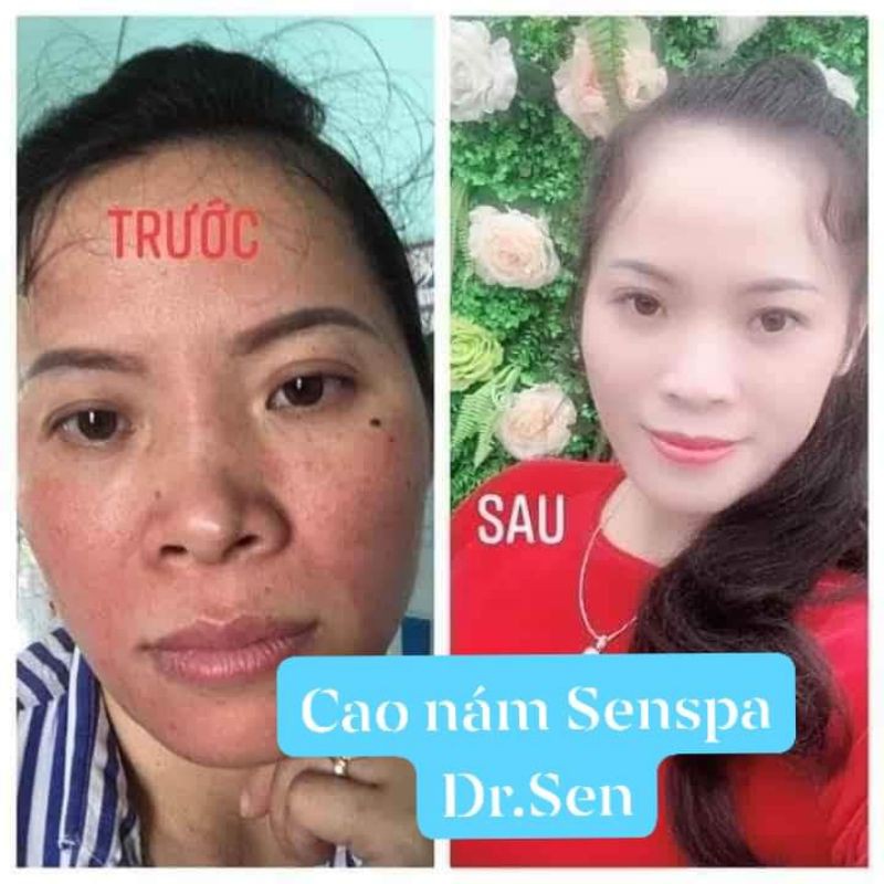 Dr.sen Cao Nám Sen Spa