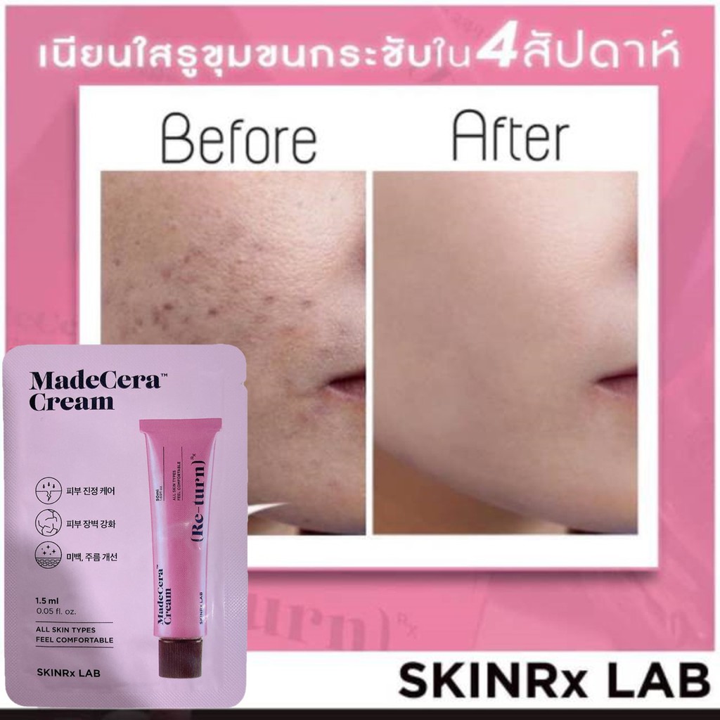 [Quà Tặng Không Bán] Kem dưỡng da mặt dưỡng ẩm, ngăn lão hóa SKINRx LAB Madecera Cream 1.5ml - Sample size for Huxley | BigBuy360 - bigbuy360.vn