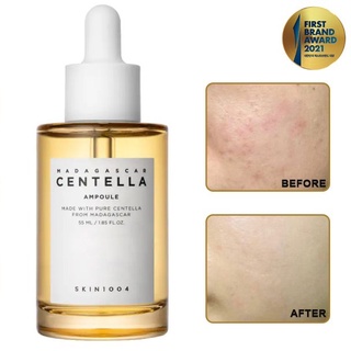 Serum rau má madagascar centella skin1004