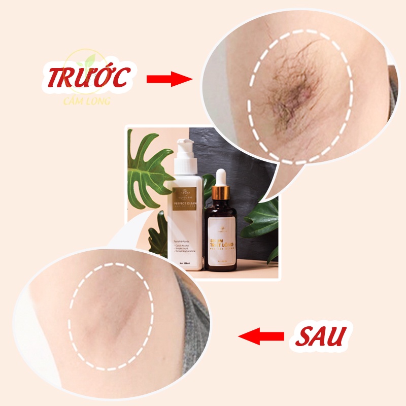 Wax Lông Body Toàn Thân Nách Chân Tay Huyền Phi Chính Hãng HP14 Tặng Serum Kem Triệt Lông Vĩnh Viễn