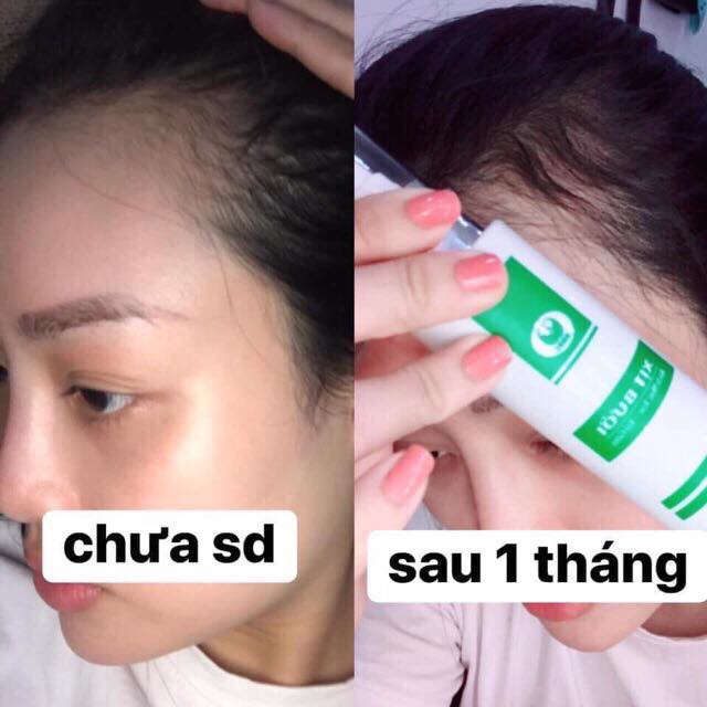 Xịt Bưởi Kích Thích Mọc Tóc , Làm Dài Tóc , Giảm Rụng Tóc , giảm Gàu Chai 100ml | BigBuy360 - bigbuy360.vn