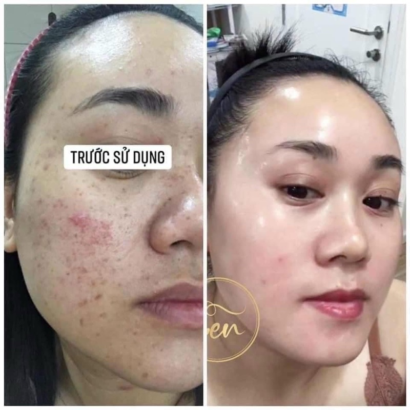 Tinh Chất Dưỡng Tái Tạo Da Dược Phẩm Sen - 30ML | BigBuy360 - bigbuy360.vn